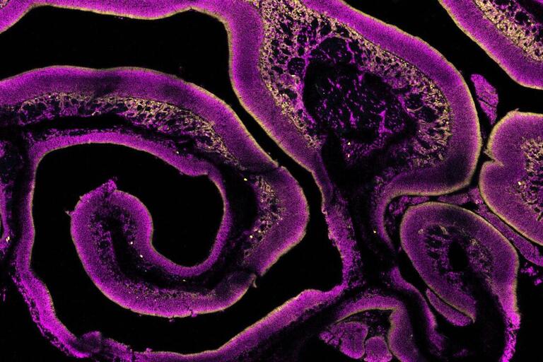 Microscoping imaging of mouse epithelium with violet squiggles