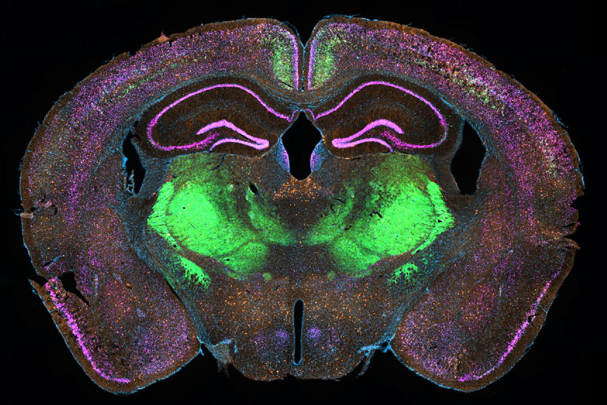 An image of a brain with different colors representing different neurons over a black background.