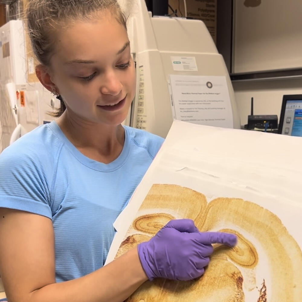 Anna Jacobowitz points to an area of the brain on a large print-out, with lab equipment in the background