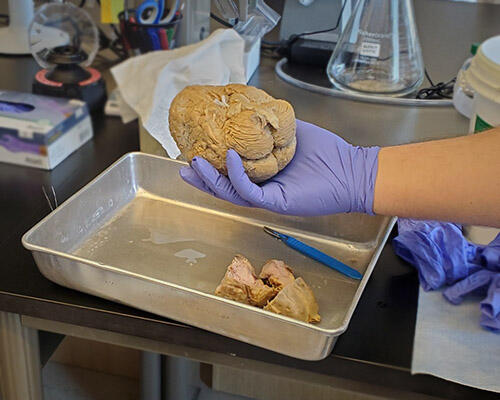 A researcher uses gloves to hold a brain for attendees to view.