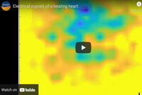 Beating Heart Video of Electrical Signals