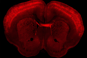 Brain slice from a transgenic mouse