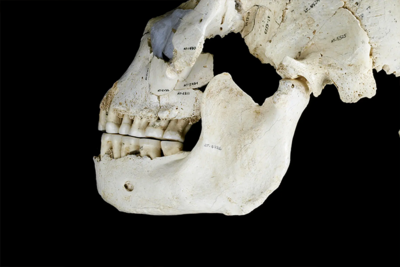 Side view of a human skull's jaw and teeth set against a black background